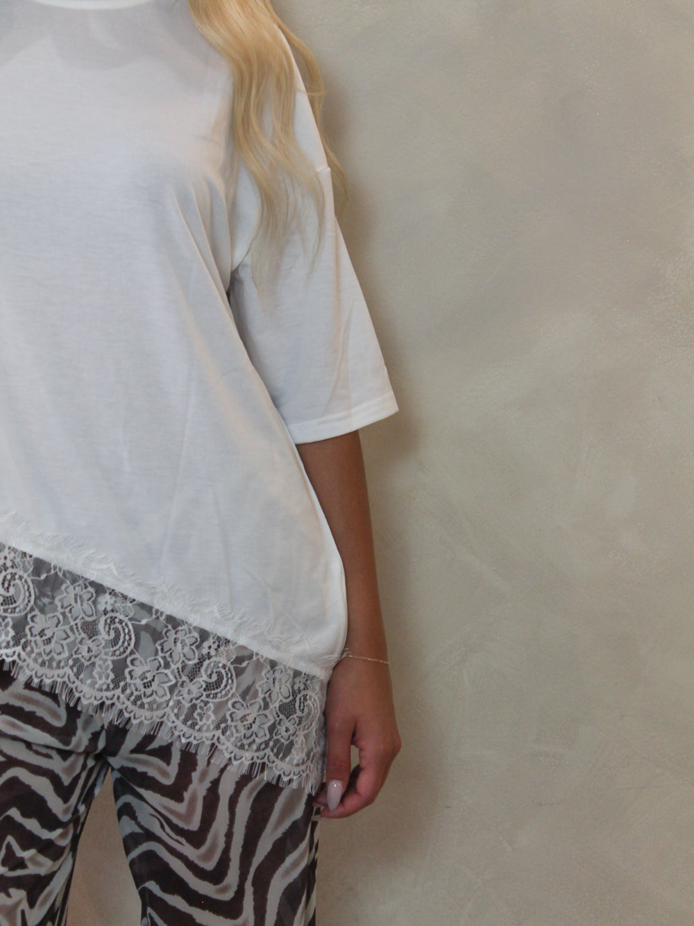 A detail short of a model wearing an oversized white short-sleeve top and zebra-print pants.