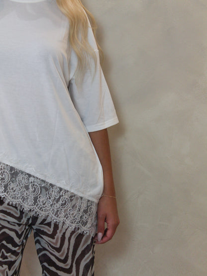 A detail short of a model wearing an oversized white short-sleeve top and zebra-print pants.